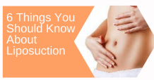 6 Things You Should Know About Liposuction