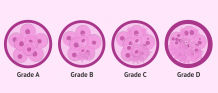Embryo Grading and Success Rates