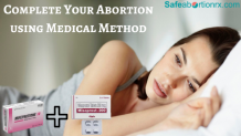 Complete Your Abortion using Medical Method - safeabortionrx blog