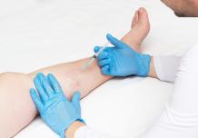 Considering A Vein Doctor? Here Are Some Tips