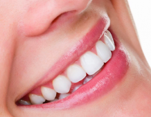 How To Find The Finest Dentist in Penrith