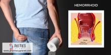 What’s the Difference Between External and Internal Hemorrhoids?