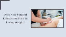 Does Non-Surgical Liposuction Help In Losing Weight? - Skinovate