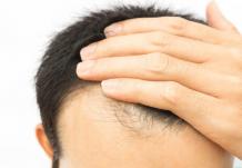 Does PRP stop hair fall? &#8211; Hair Transplant Clinic Dubai