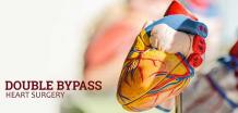 double bypass heart surgery in India