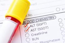 SGPT &amp; SGOT Test: normal range, its levels, and what do they indicate? - MyHealth