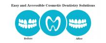 Easy and Accessible Cosmetic Dentistry Solutions | Smile Makeover in Pune