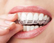 Invisalign in Dubai - Invisible Clear Aligners - Dr Joy Dental Clinic Dubai