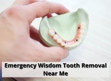 Best Dental Clinic for Emergency Wisdom Tooth Removal