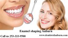 Enamel shaping Auburn | Cosmetic Dentistry auburn | Dental Implants near me