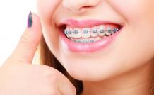 How Experienced Orthodontists Help You Straighten Your Teeth &#8211; Believe In Doctors Studio