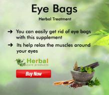 Natural Remedies for Eye Bags What You Do’s and Don’ts During Treatment - Herbal Care Products