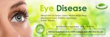 7 Most Important Herbal Supplement for Eye Diseases Prevention