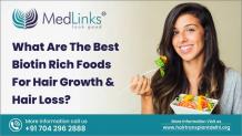 Biotin Rich Foods For Hair Growth | Medlinks