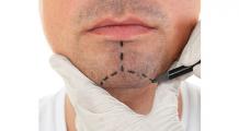 Enhance Your Facial Features and Beauty with Chin Surgery