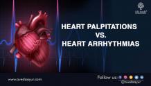 Heart Arrhythmia vs Heart Palpation