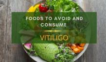 Diet Plan for Vitiligo - Healthy Diet for Leucoderma