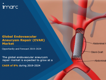 Endovascular Aneurysm Repair (EVAR) Market Report and Forecast 2019-2024