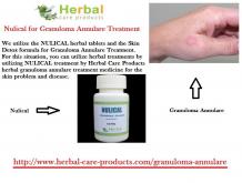 Granuloma Annulare Natural Treatment - Herbal Care Products