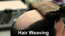 Hair Weaving treatment clinic in India | Hair Transplant India