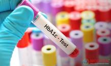   	HbA1C Tests in Gurgaon | MDRC India  