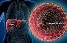 How to Treat Hepatitis B Virus in Ayurveda?