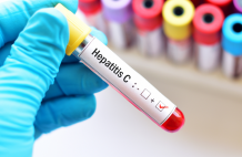 Sovihep V Tablets to Treat HCV