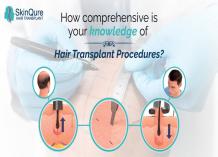 Best Hair Transplant Clinic In Delhi NCR | Skin Qure 