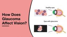 How Does Glaucoma Affect Vision | Dr. Jeevan Ladi