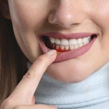 Periodontics &amp; Gum Disease Treatment in Dubai &amp; Abu Dhabi | Cost &amp; Price