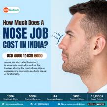 How Much Does A Nose Job Cost in India? - GoMedii