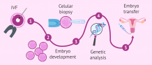 How is Embryo Selection Done?