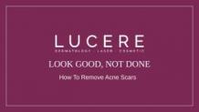 How To Remove Acne Scars - Lucere Clinic