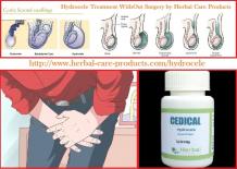 Natural Herbal Treatment For Hydrocele Symptoms