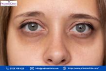 hyperpigmentation around eyes