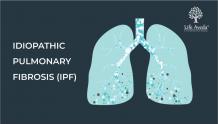 IPF treatment