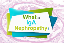  What Is Iga Nephropathy?