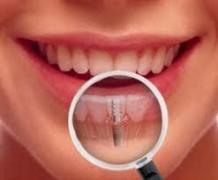 Dentist Bundoora - Emergency Dentistry | Dental Clinic Bundoora