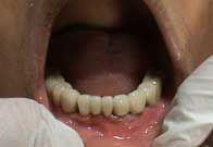 Best Dental Clinic, Dentist in Ashok Vihar, Delhi | Modi Dental