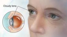 Are you looking best Cataract surgeons in Chicago IL? - teemey