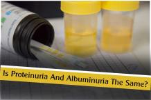 Is Proteinuria And Albuminuria The Same?