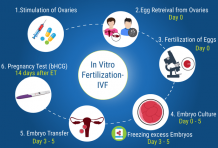 What is the procedure of IVF in Kathmandu 2021? Select IVF Nepal