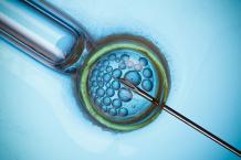 IVF - What To Expect