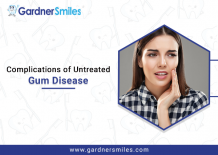 Complications of Untreated Gum Disease