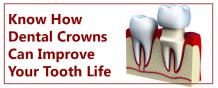 Know How Dental Crowns Can Improve Your Tooth Life | Dental Cap