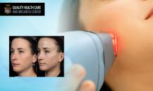 Laser face treatment New Jersey,Clear+brilliant laser treatment New Jersey