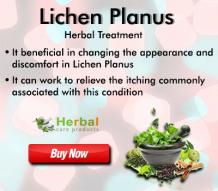 Lichen Planus Herbal Treatment