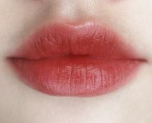 Best Lip Enhancement &amp; Augmentation Near Toronto | Tight Clinic