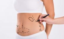 Liposuction Surgery Cost in India