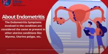 Topic Guide: About Endometritis